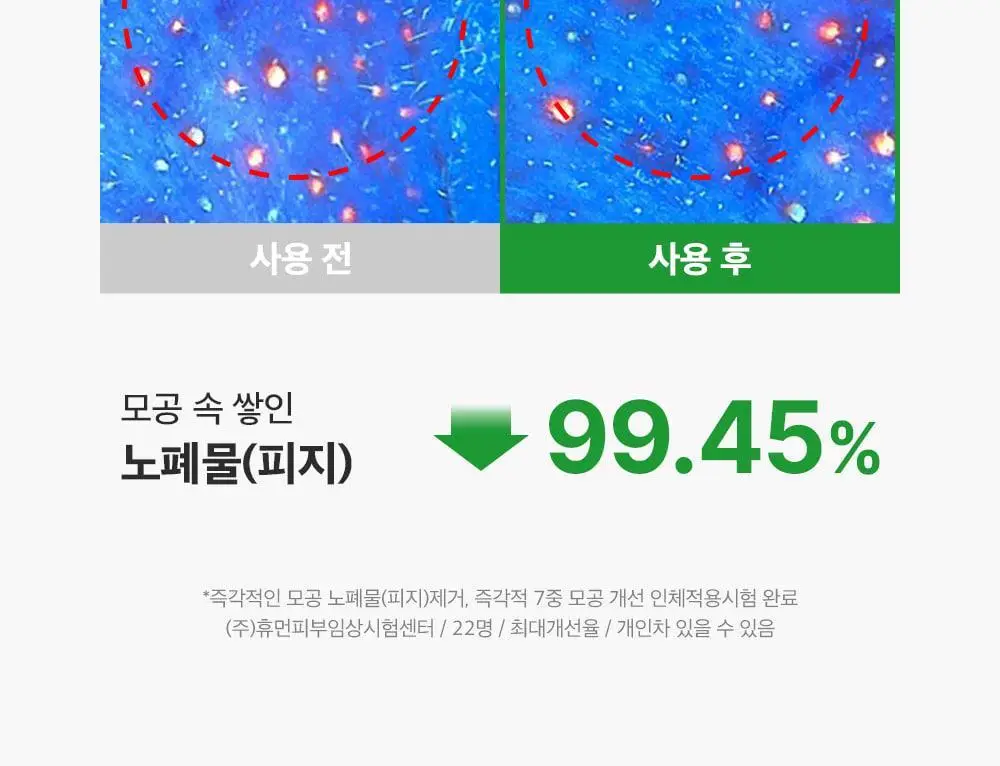 [모공딥클렌징] 성분에디터 그린토마토 딥 포어 클렌징 울트라 휘핑 폼 120g 상세페이지 47